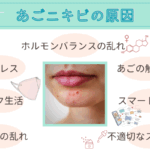 あごニキビはお腹をゆるめなさい